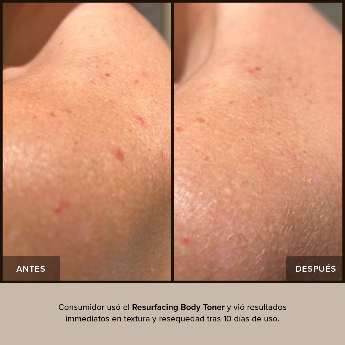 NUDEBODY RESURFACING BODY TONER (TÓNICO REJUVENECEDOR)